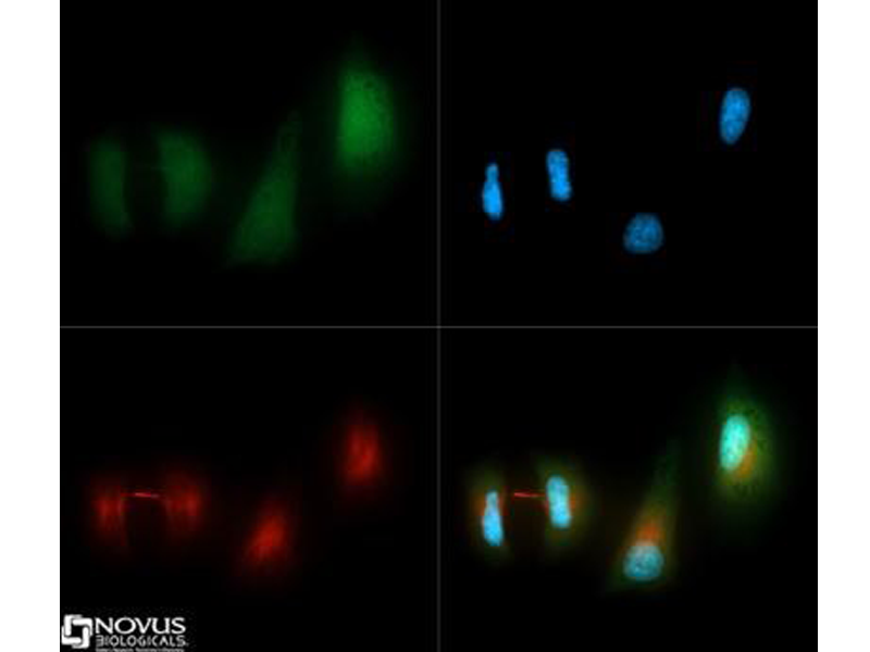 Read more about the article Novus畅销自噬产品精选：LC3 Antibody